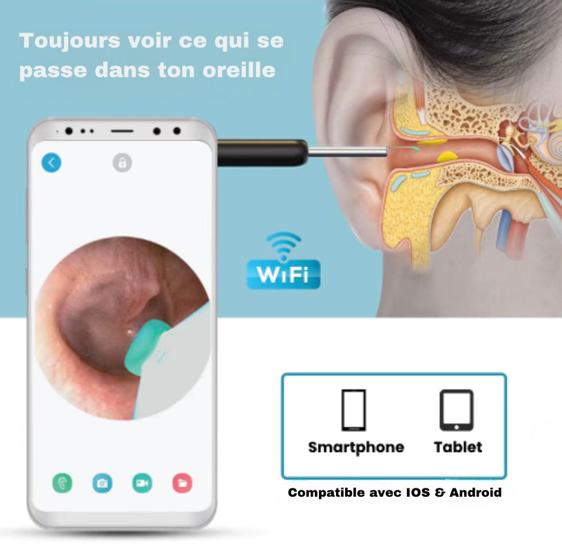 ClearScope - Nettoyeur d'oreilles innovant avec caméra HD